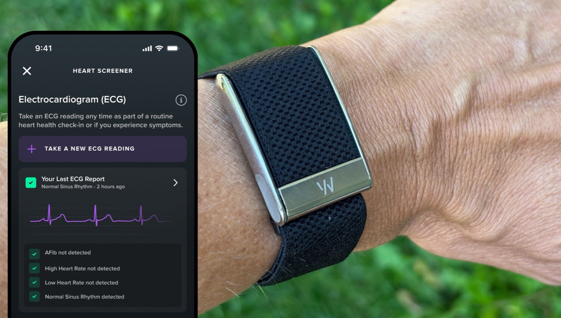 Whoop 5.0 MG One Peak Life paketleri karsilastirma